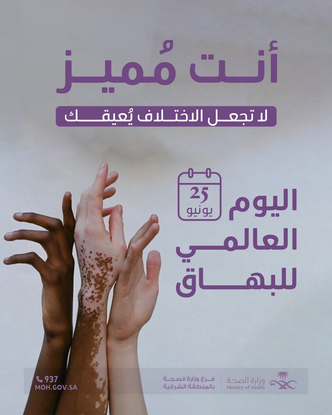 #تفاعل| 

أنت مُميز، لا تجعل الاختلاف يُعيقك 

#اليوم_العالمي_للبهاق 
#صحة_الشرقية